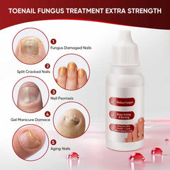 DERMFREE bottle next to coin for size scale conveying travel-friendly convenience