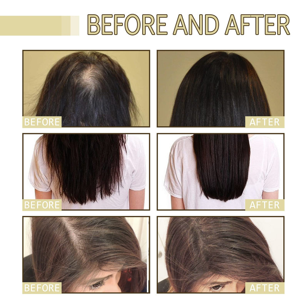 Deuiosna Carvenchi applied to scalp during massage for nourishment