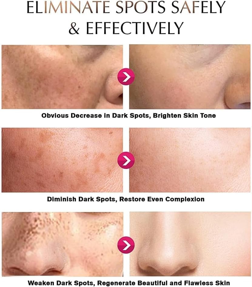 Deuiosna cream applied to underarm demonstrating targeted brightening use