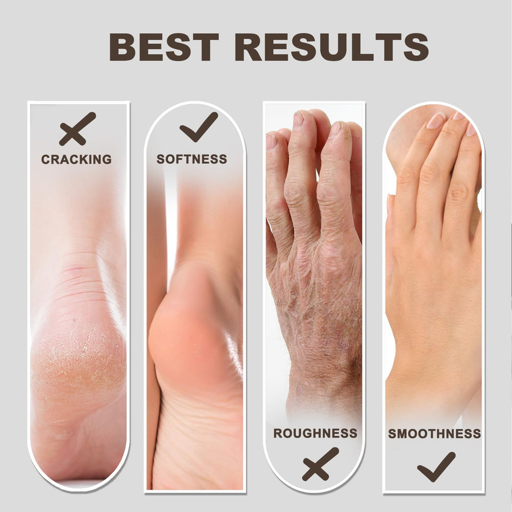 Devyonder being applied to heel demonstrating callus softening benefit