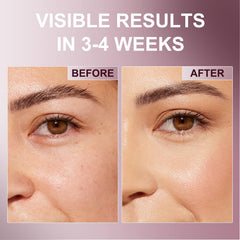 Devyonder product label listing retinol caffeine niacinamide benefits