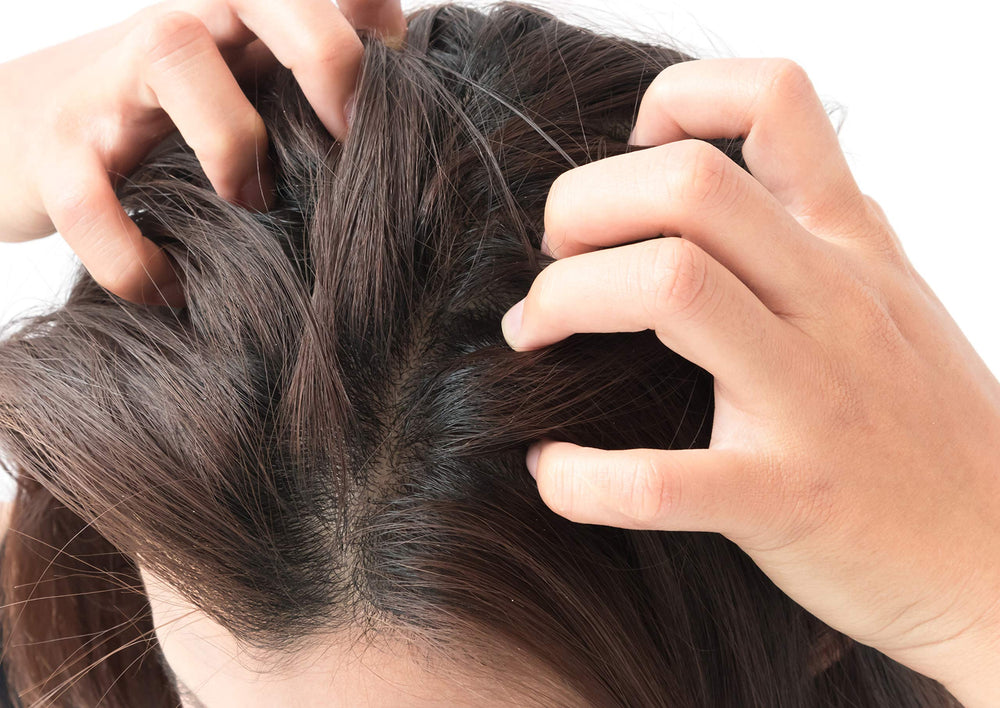 Difeel being applied to scalp with fingers to soothe dryness and reduce flaking