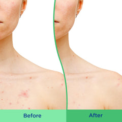 Applying Differin body scrub in palm demonstrating smooth spread and coverage benefit