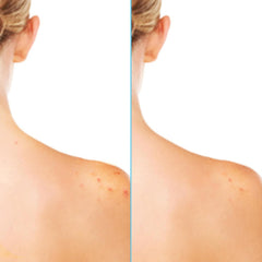Differin in a gym bag after workout showing on-the-go acne care