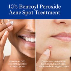 Differin cream texture on fingertip demonstrating smooth spreadability and hydration