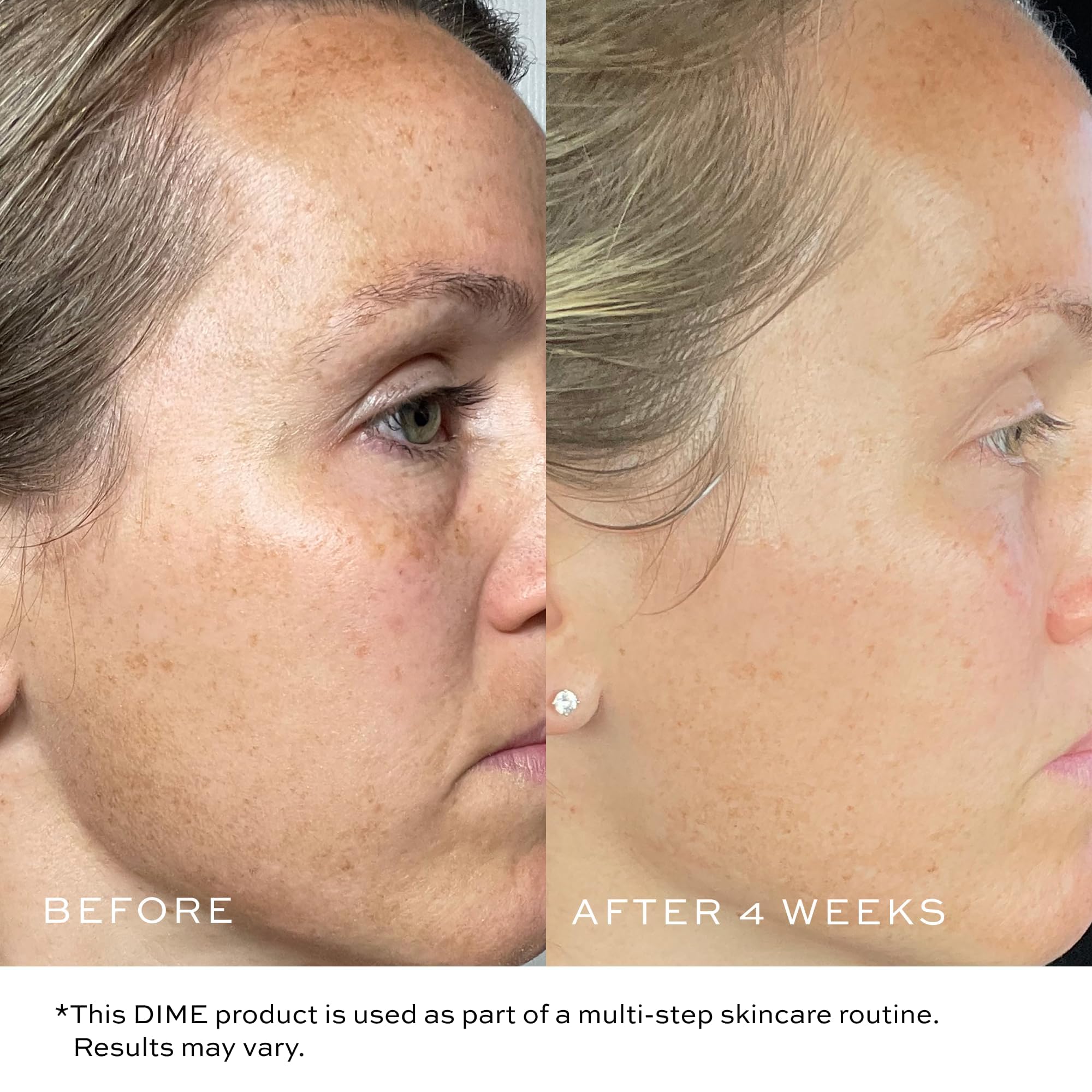 DIME bakuchiol ingredient arrangement highlighting natural retinol alternative benefit