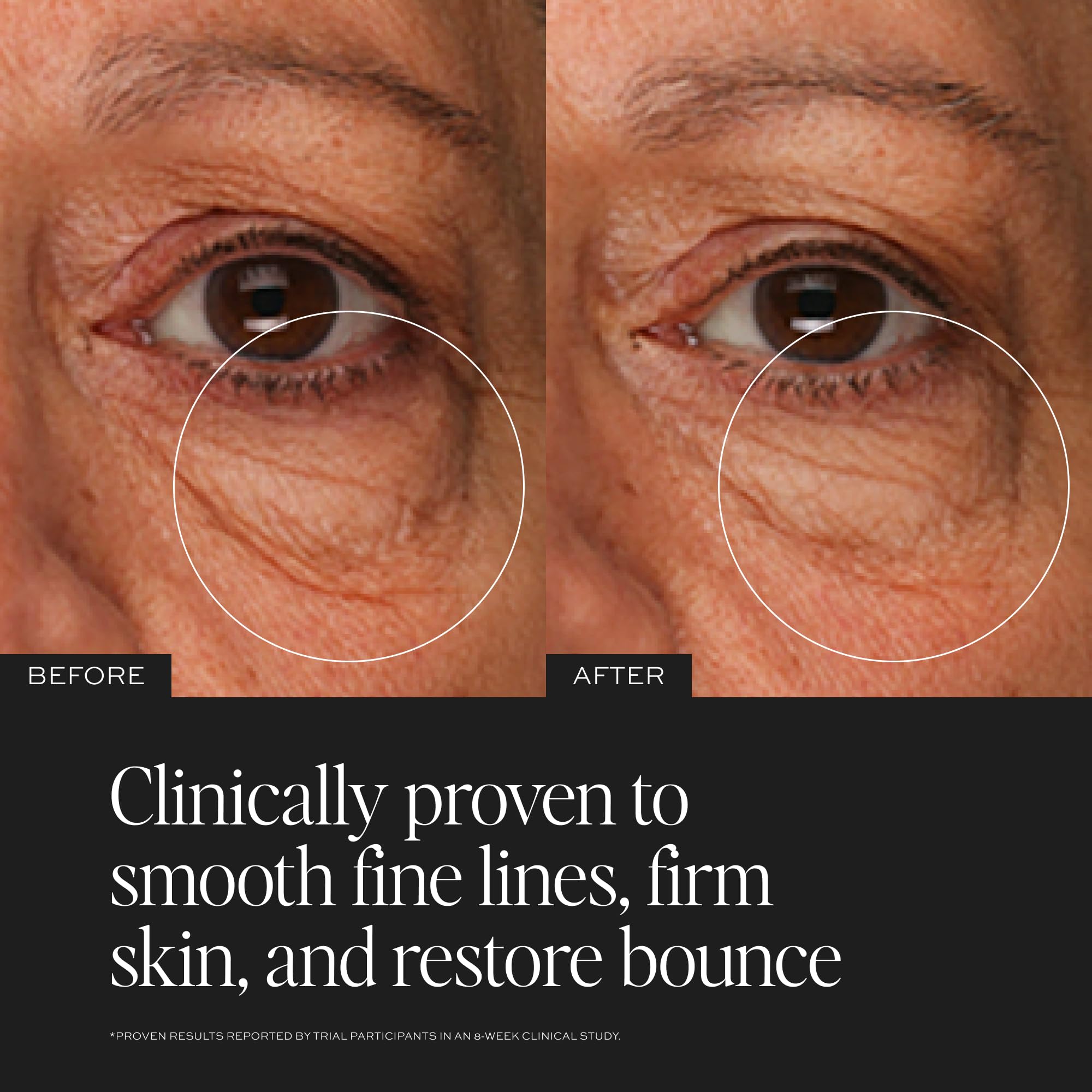 DIME cream being applied under eye to smooth and hydrate skin