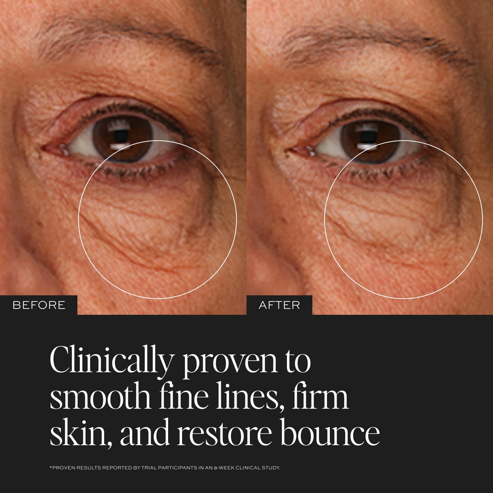 DIME cream being applied under eye to smooth and hydrate skin