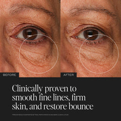 DIME cream being applied under eye to smooth and hydrate skin