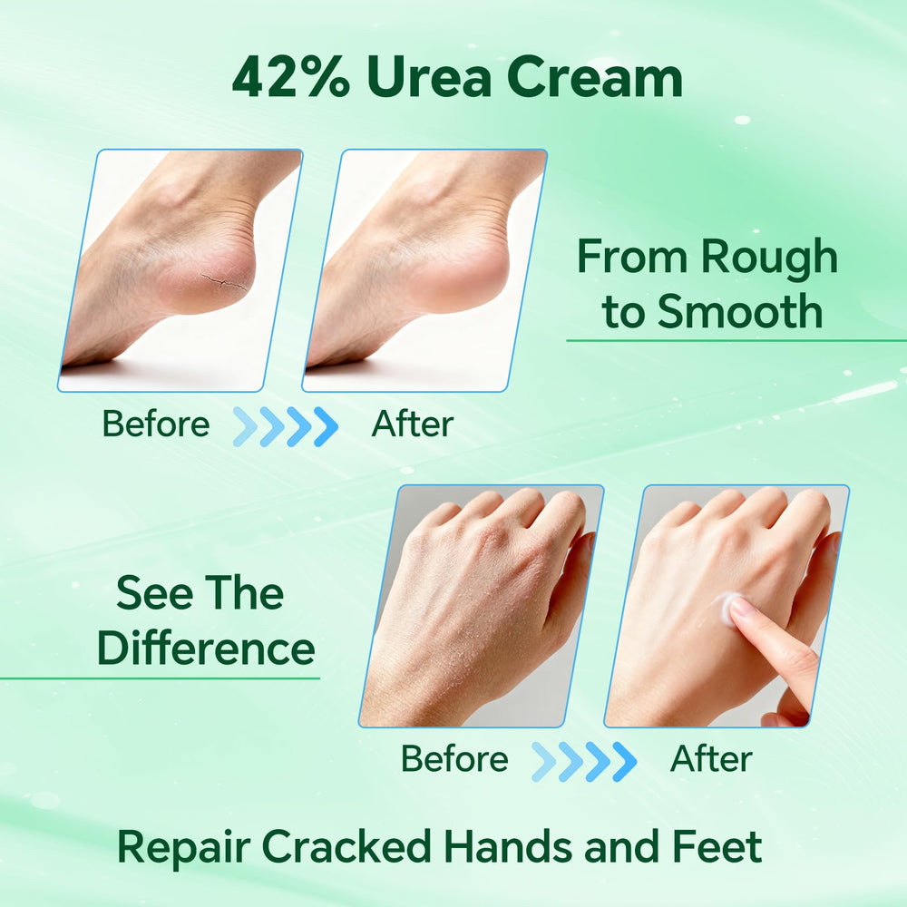 Discoliner label ingredients closeup highlighting 42% urea and nourishing actives