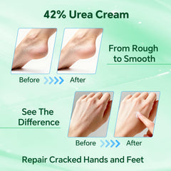 Discoliner label ingredients closeup highlighting 42% urea and nourishing actives
