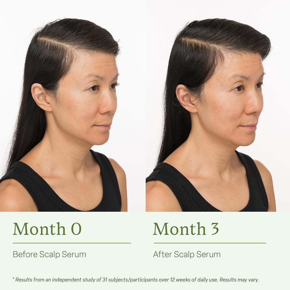 divi scalp serum being applied to scalp, targeted coverage for thinning areas
