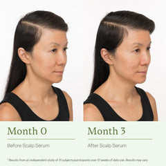 divi scalp serum being applied to scalp, targeted coverage for thinning areas