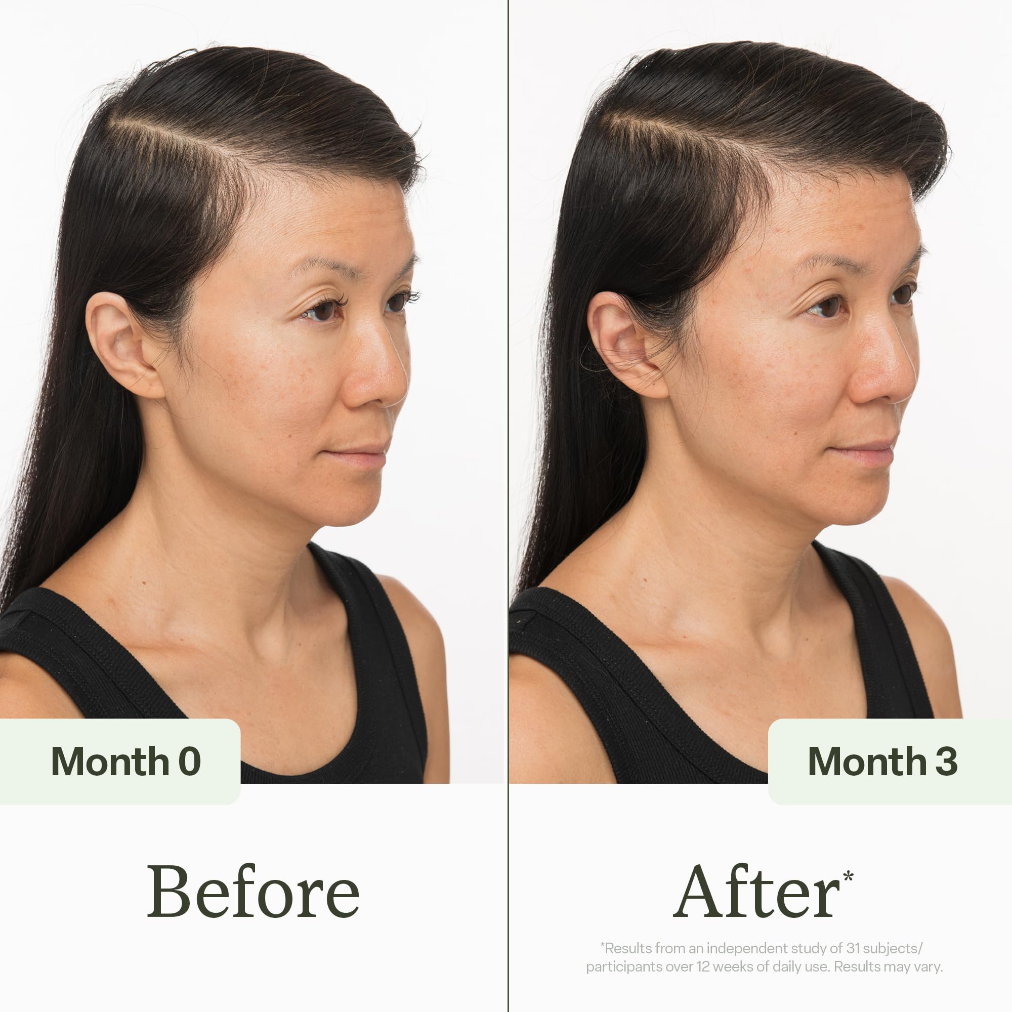 divi scalp serum with rosemary and coffee beans emphasizing natural actives benefit