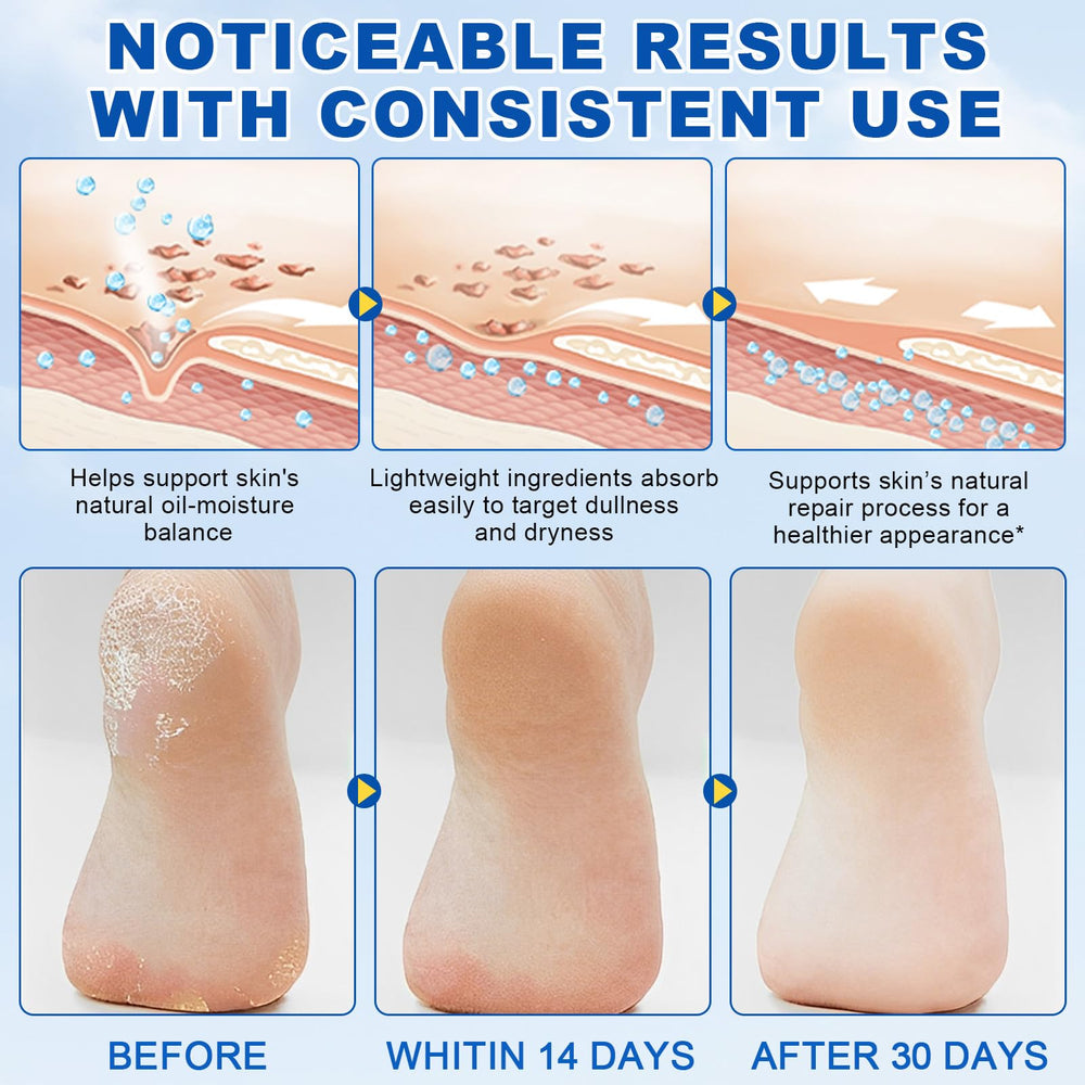 DLOMFVFQ being applied to heel showing targeted relief for cracked skin