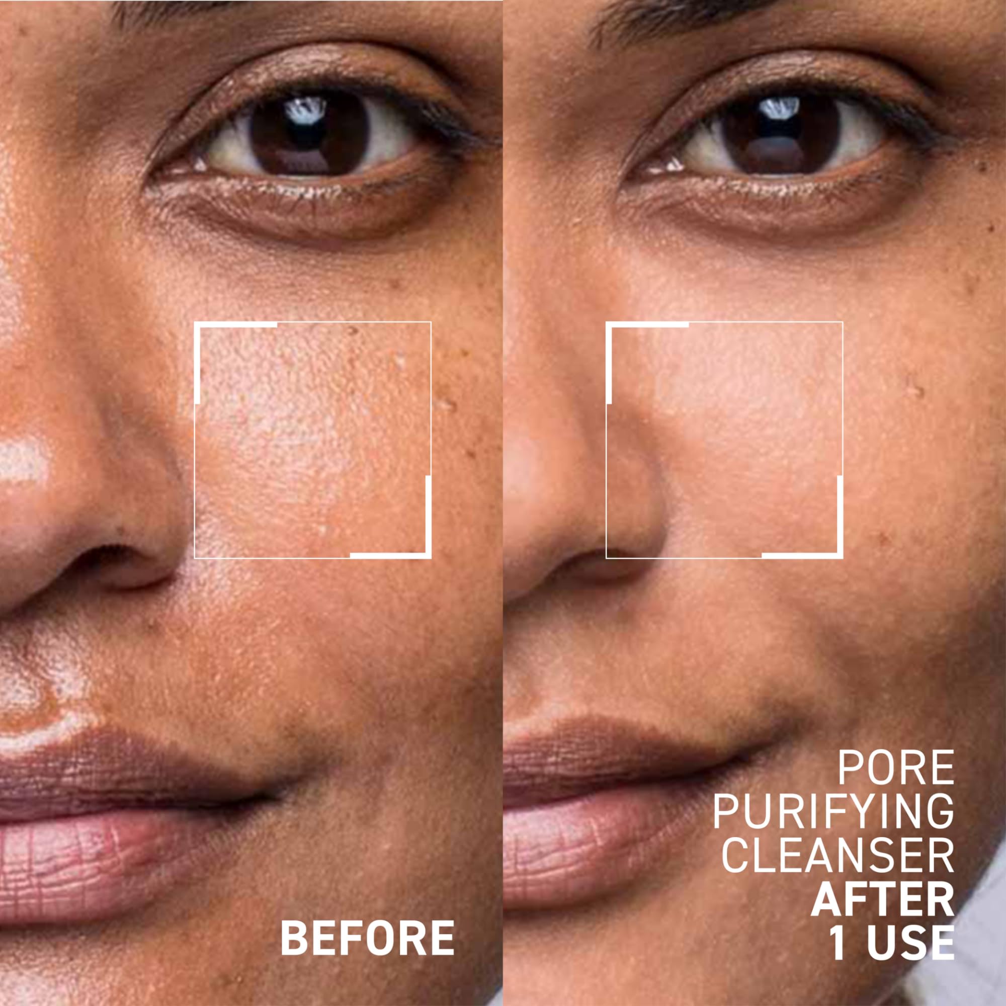 Dr. Brandt gel texture close-up highlighting smooth lather and gentle exfoliation