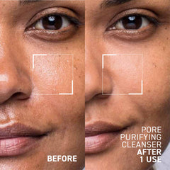 Dr. Brandt gel texture close-up highlighting smooth lather and gentle exfoliation