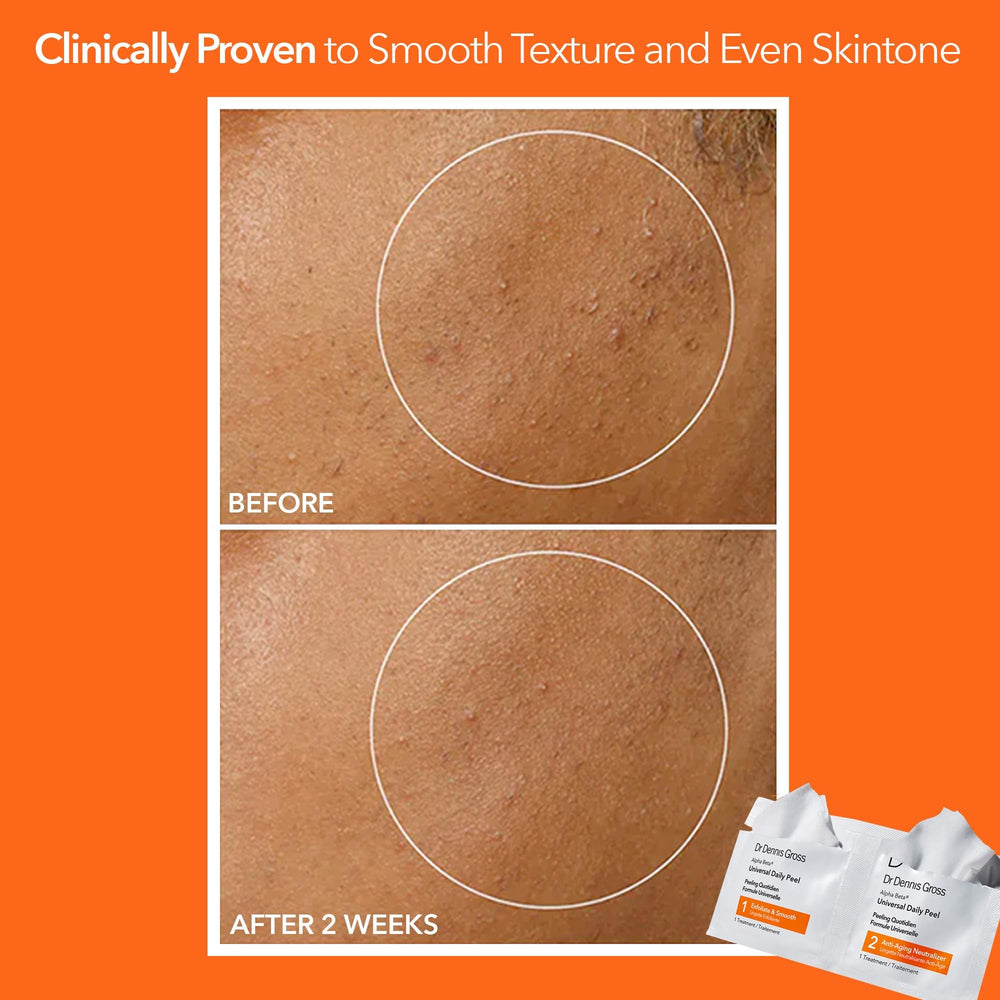 Dr. Dennis Gross open kit with pads visible for convenient daily treatments