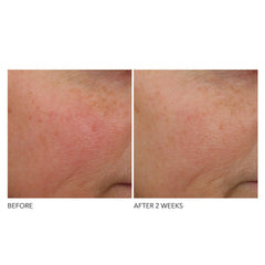 Dr Dennis Gross ferulic acid ingredient focus emphasizing antioxidant support