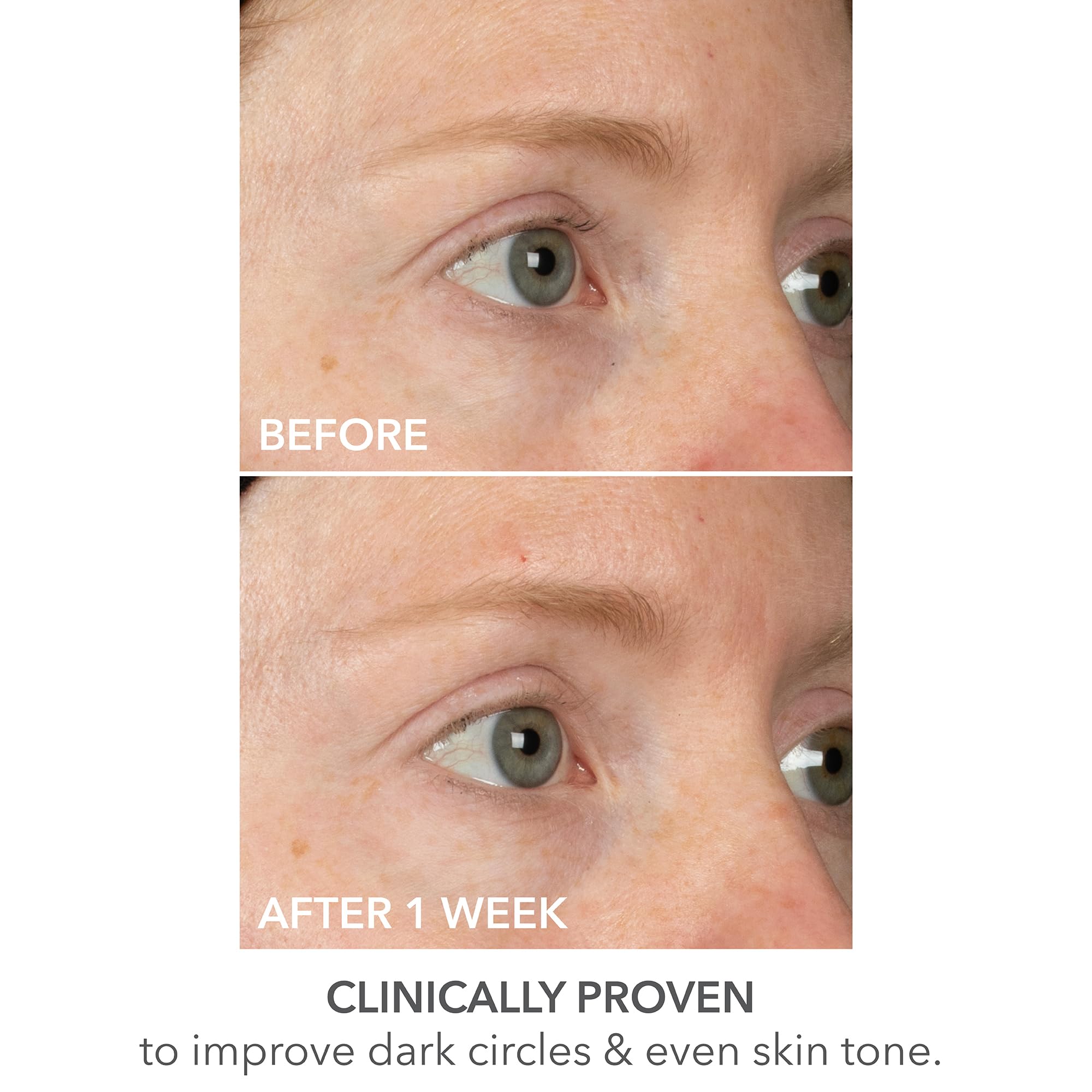 Dr Dennis Gross mask paired with DRx SpectraLite device illustrating enhanced routine