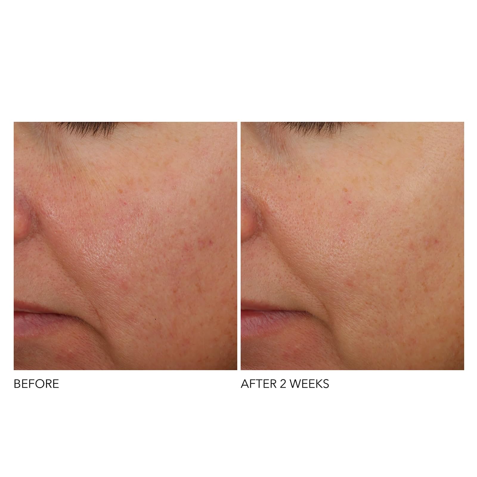 Dr Dennis Gross nighttime routine application on face showing easy layering