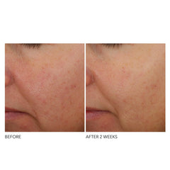 Dr Dennis Gross nighttime routine application on face showing easy layering