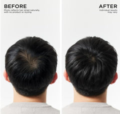 Dr Groot in-shower use showing scalp massage for improved hair vitality