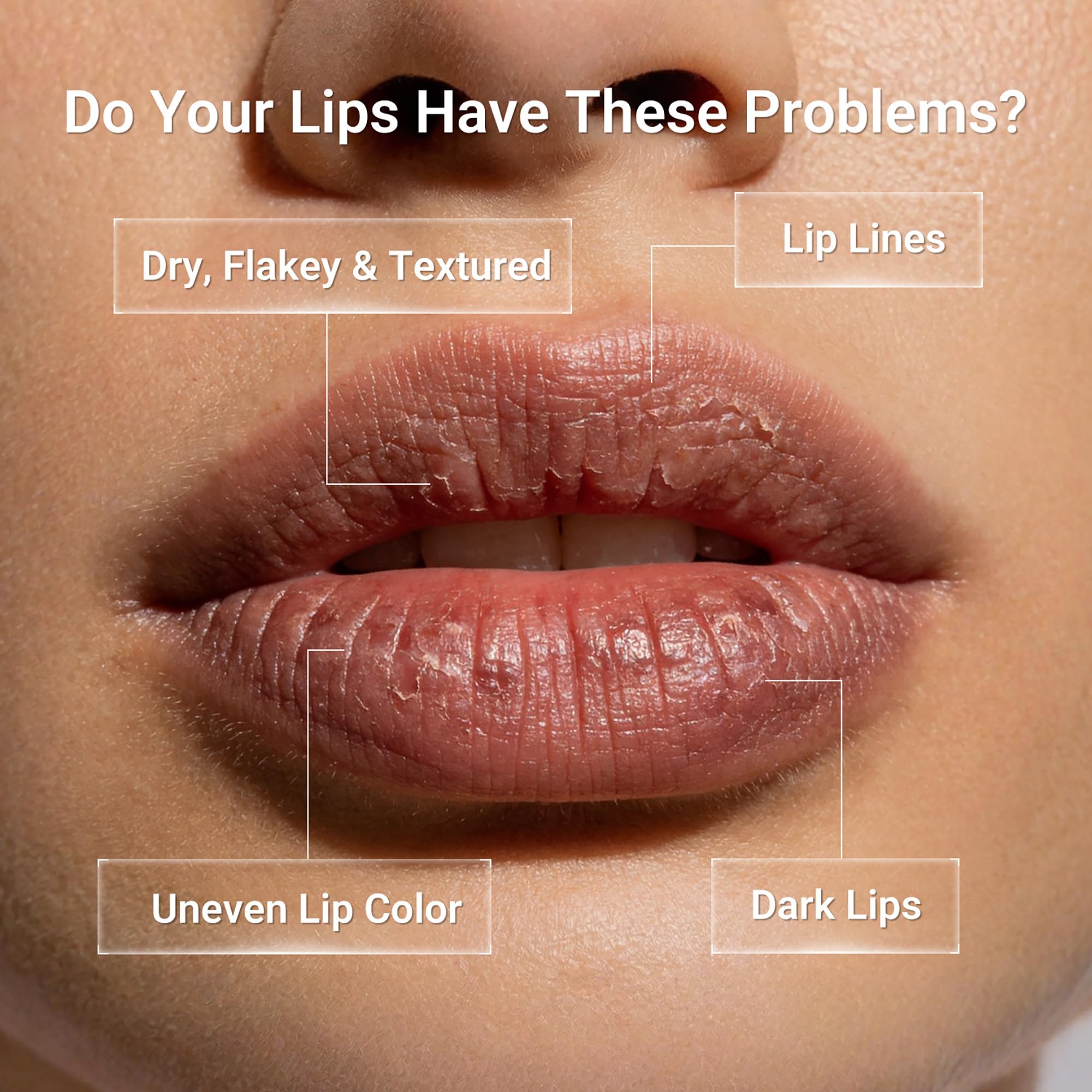 Dr.Leo applied to lips in daytime showing smooth finish and makeup-ready base
