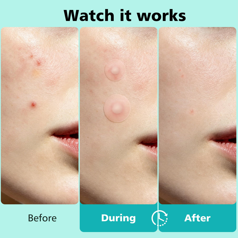 Dr.patch applied to cheek demonstrating discreet coverage and protection