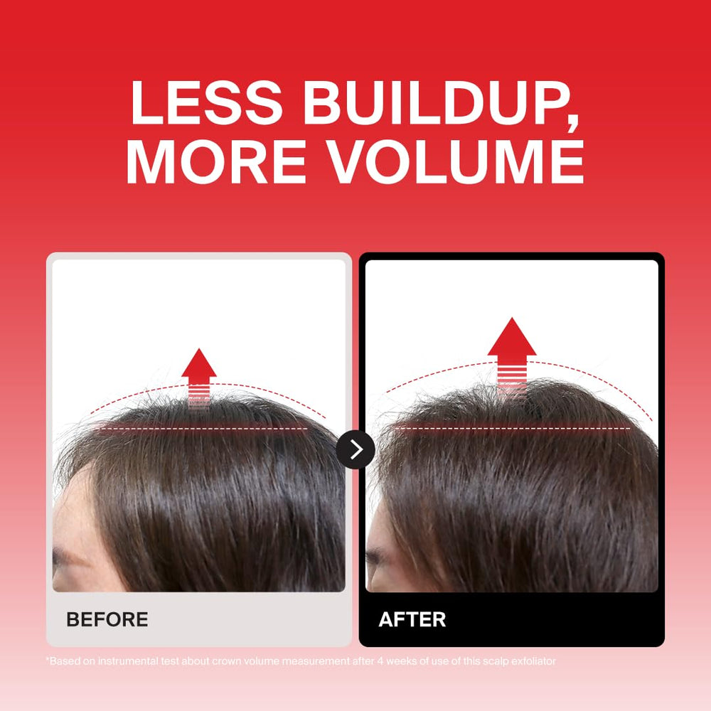 DR.FORHAIR applied on damp scalp demonstrating targeted exfoliation