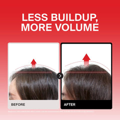 DR.FORHAIR applied on damp scalp demonstrating targeted exfoliation