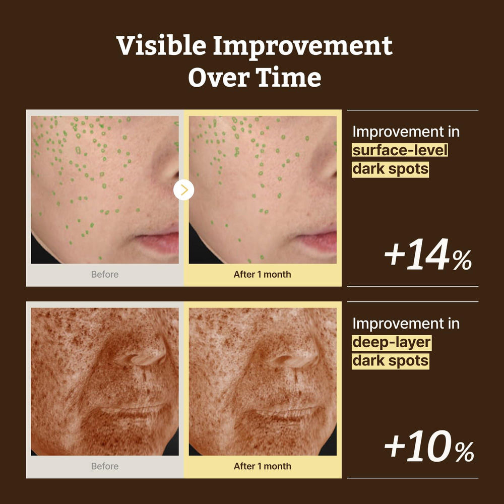 Dr.Reju-All serum layered with cream illustrating how to use nightly