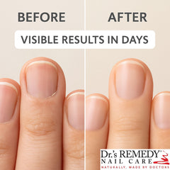 Dr.'s Remedy bottle held in hand to show compact travel-friendly size