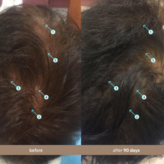 DS Laboratories scalp application in use showing targeted placement and coverage benefit