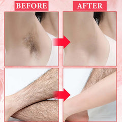 DuoZeng applied during IPL device treatment for comfort benefit