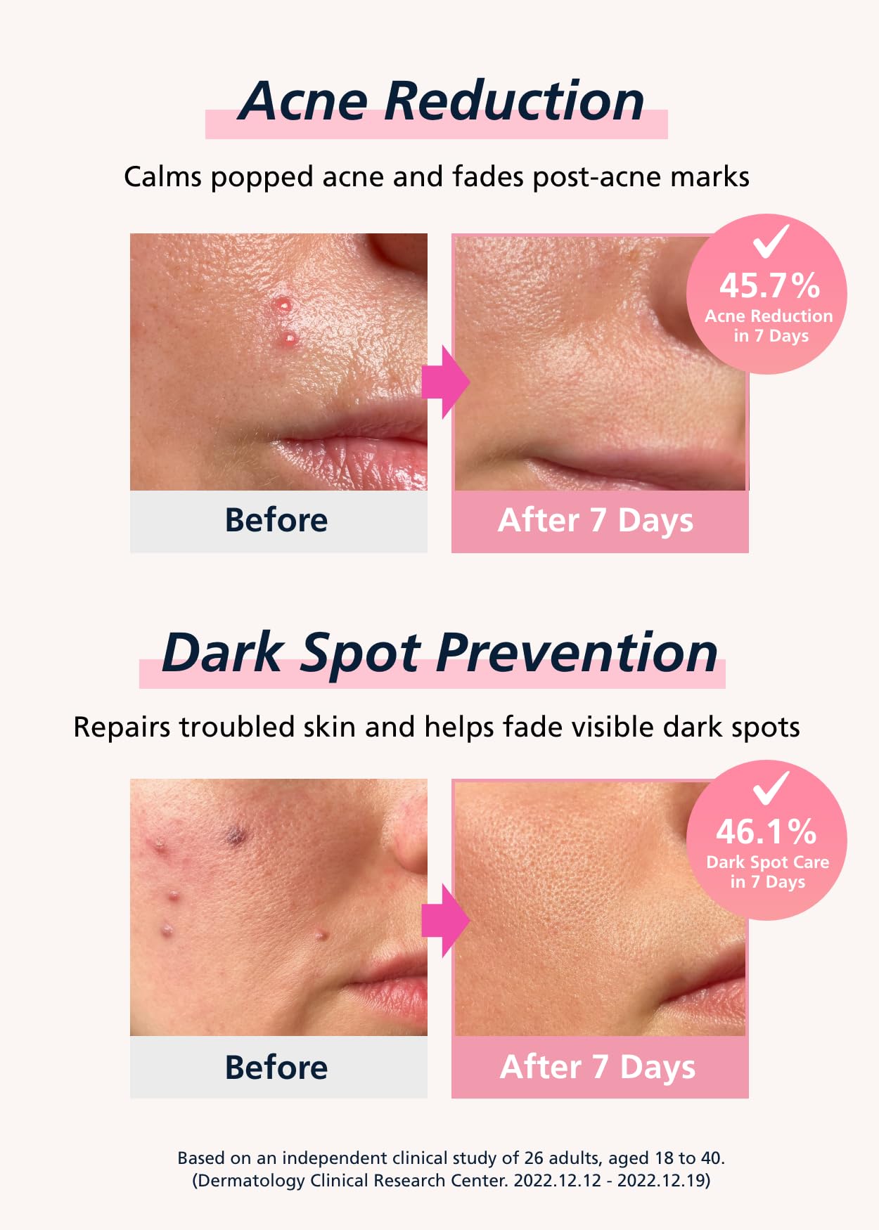 DWEasyDerm patch applied on cheek showing secure hold and comfort benefit