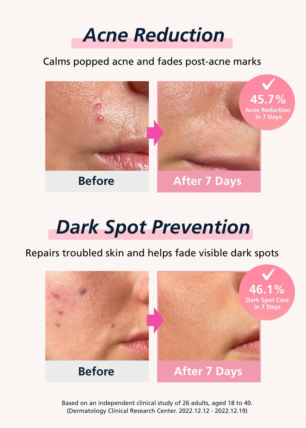 DWEasyDerm patch applied on cheek showing secure hold and comfort benefit
