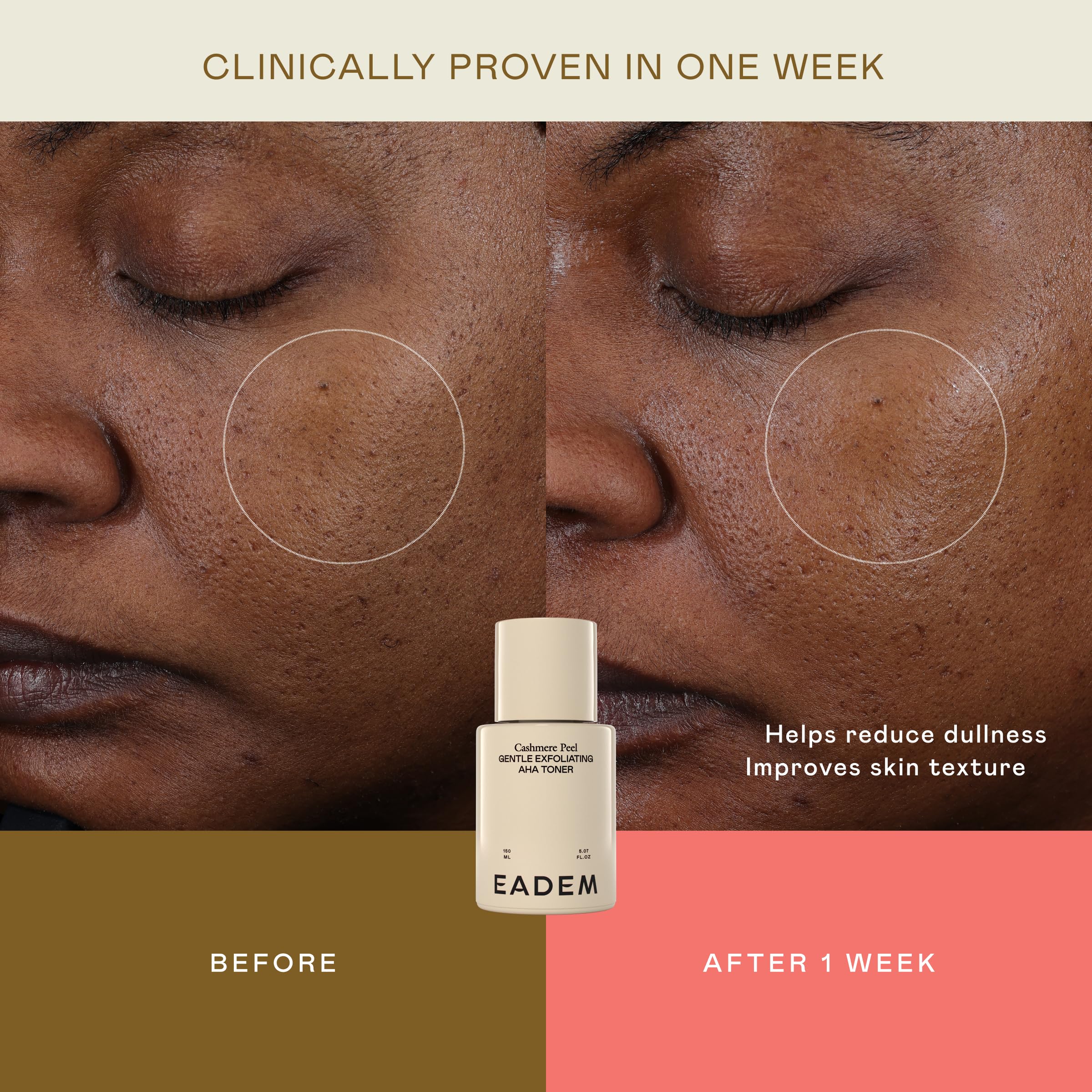 EADEM product on cotton pad demonstrating easy application benefit