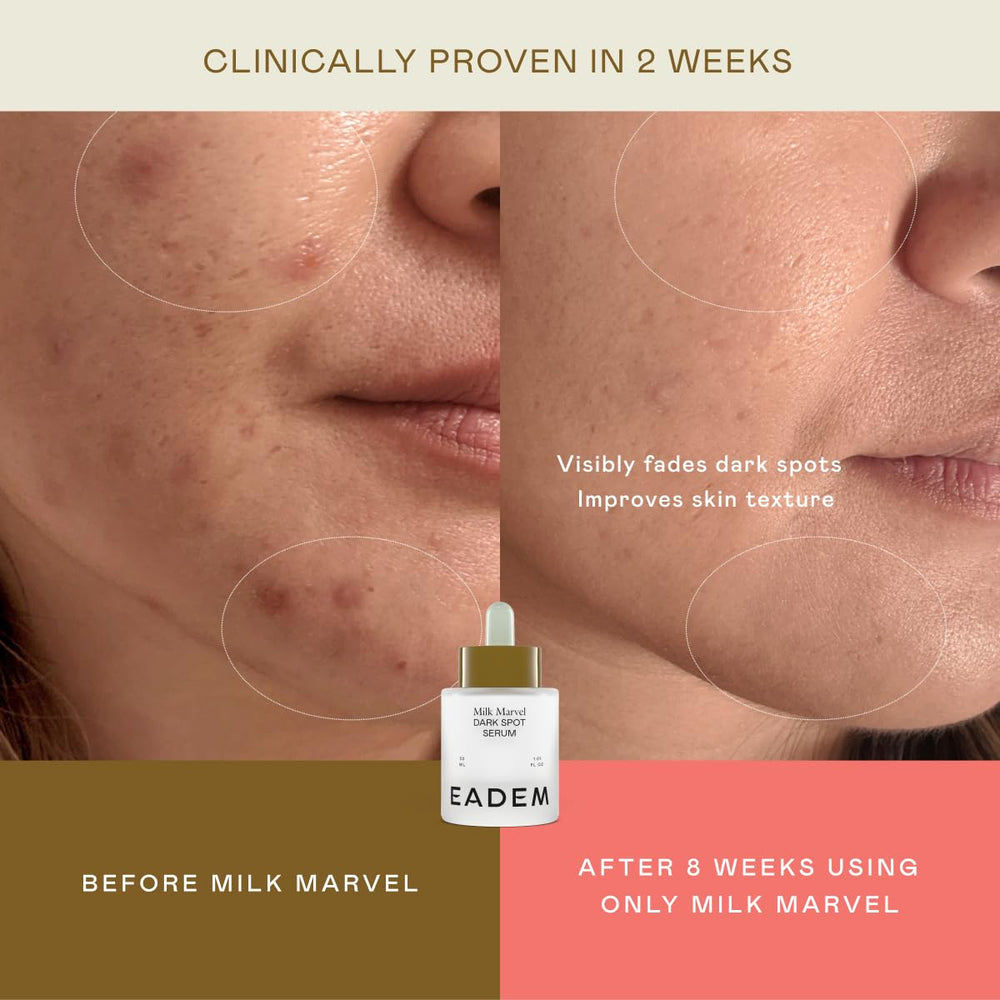 EADEM Milk Marvel texture on pipette, shows lightweight serum consistency advantage