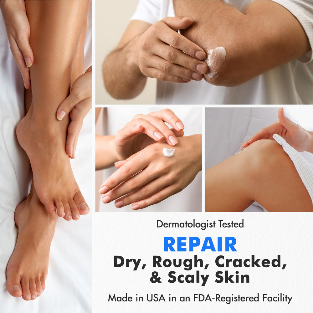 Ebanel being applied to a heel to soften calluses and cracked skin