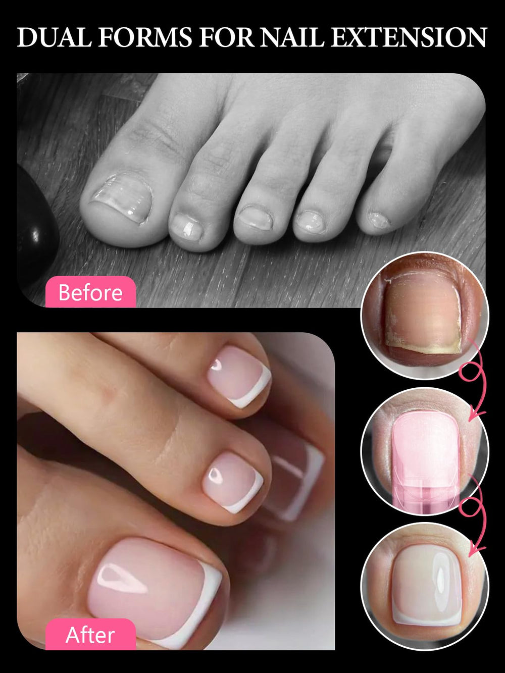 EBANKU dual form pressed on toenail during application for accuracy