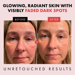 Eclat Skincare ingredients label close-up, shows key actives for reassurance