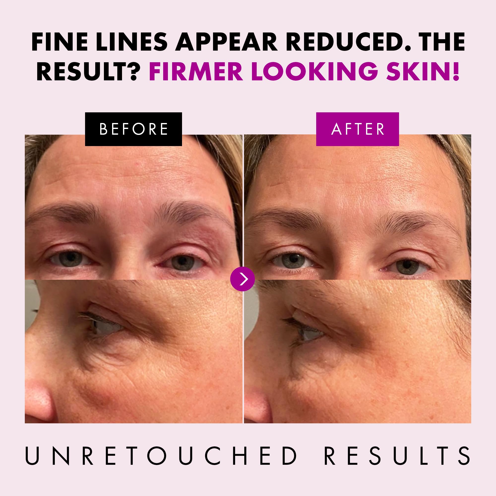 Eclat Skincare dispensing cream onto fingertip demonstrating controlled application