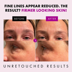 Eclat Skincare dispensing cream onto fingertip demonstrating controlled application