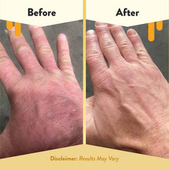 ECZEMA HONEY in kitchen sink context illustrating everyday use and compatibility benefit