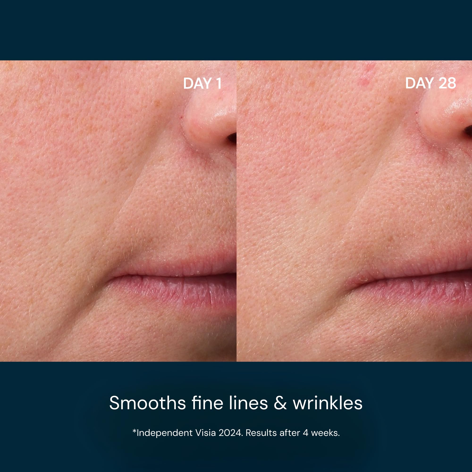 ELEMIS pump dispenser detail delivering precise serum dose with control