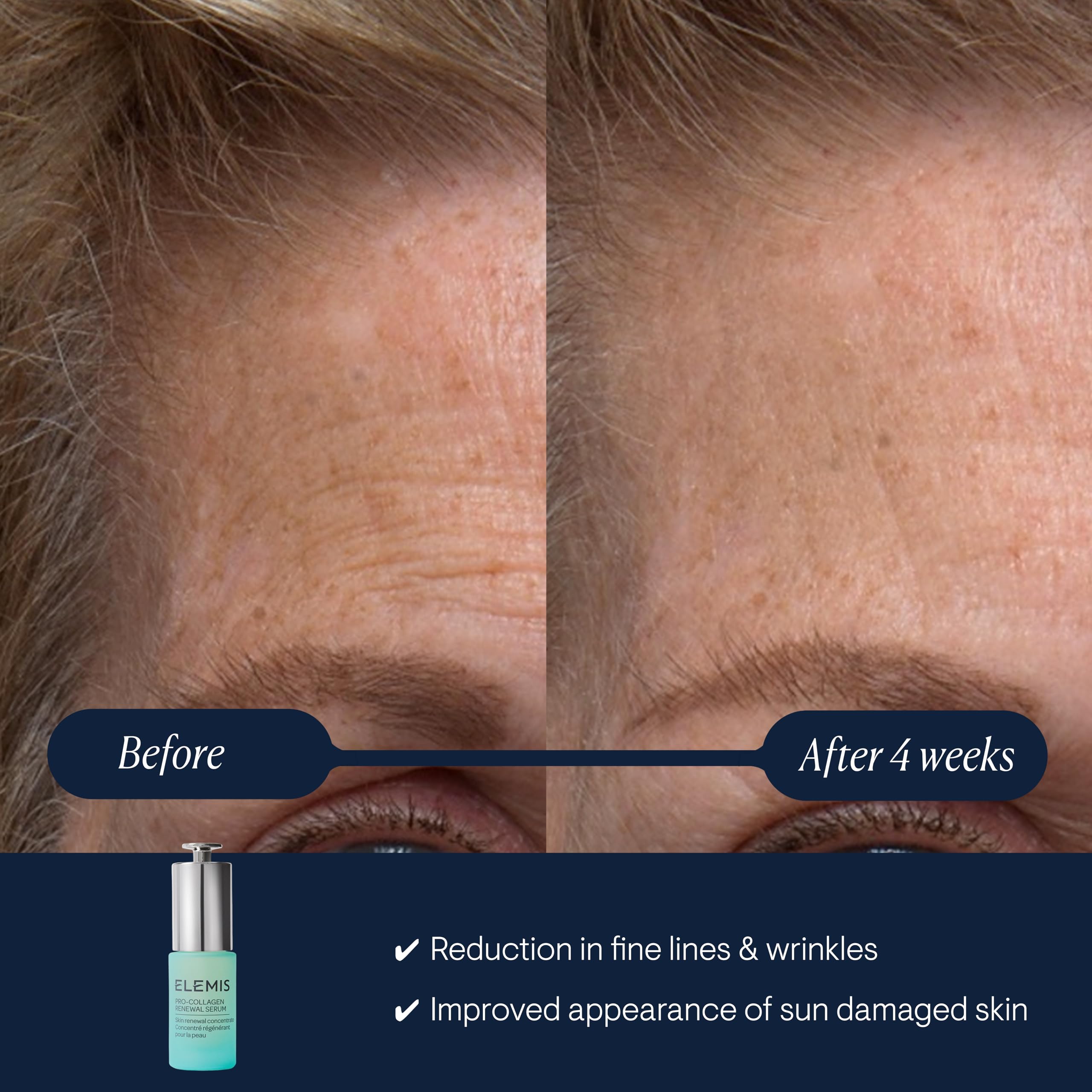 ELEMIS dropper close-up dispensing serum for precise, mess-free dosing