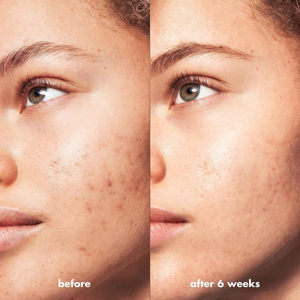 e.l.f. SKIN cleanser on bathroom counter during skincare routine showing daily use benefit