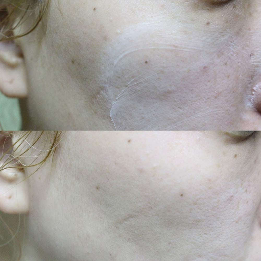 Elizavecca being applied to hand to show texture and immediate hydration benefit