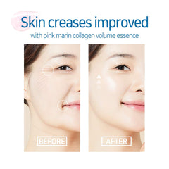 Elizavecca ingredient label close-up listing collagen and adenosine